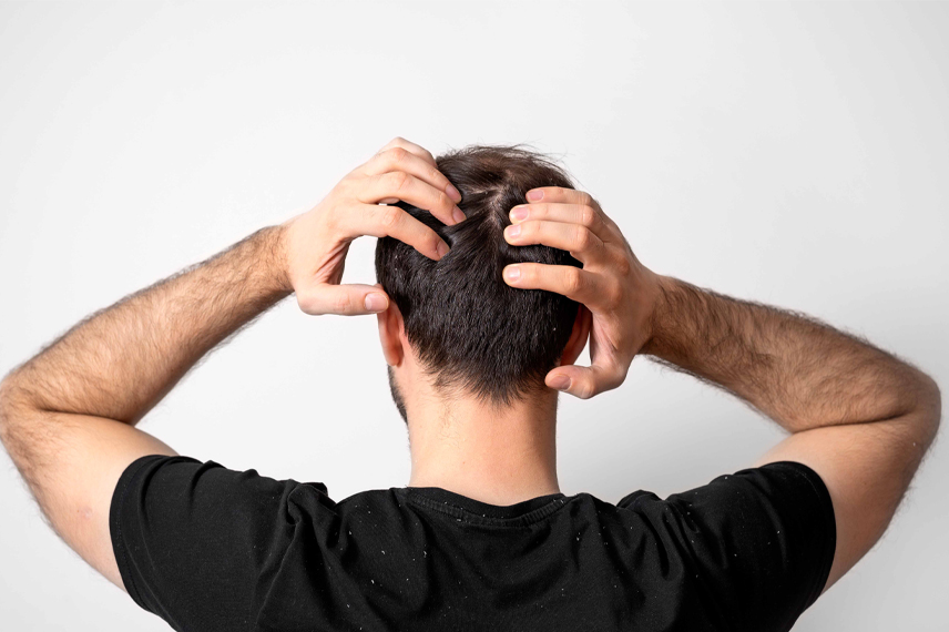 hair-transplant-side-effects