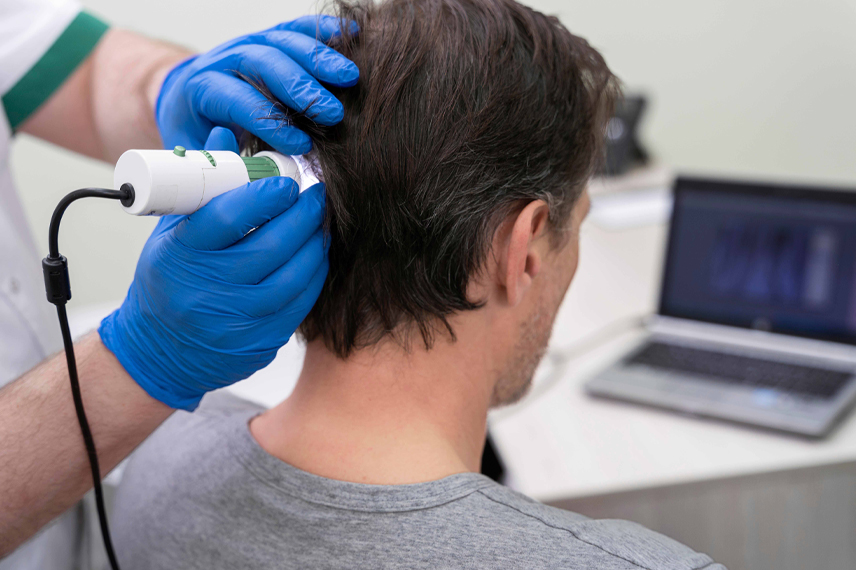 tests-before-hair-transplant